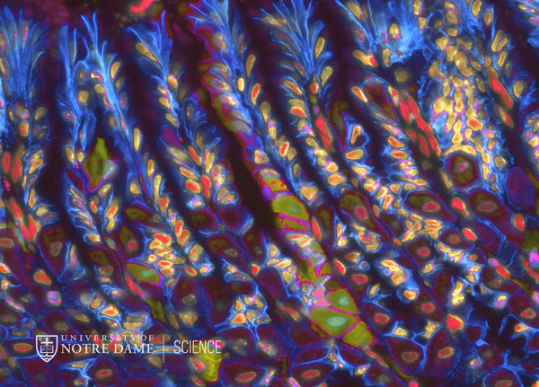 Gastric Mosaic