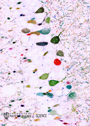 Technicolor Thoughts